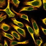 This antibody stained U-2 OS and U-251 MG cells.  The primary antibody was incubated at 2.0 ug/ml overnight at 4°C followed by a fluorescent labeled secondary antibody. Optimal concentrations and conditions may vary. Information and photo are courtesy of the Cell Profiling group, SciLifeLab Stockholm.