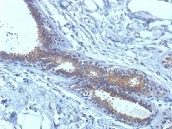 BRCA1 Antibody [BRCA1/1398]