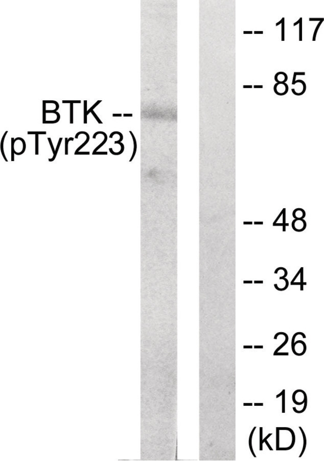 BTK (phospho Tyr223) Antibody