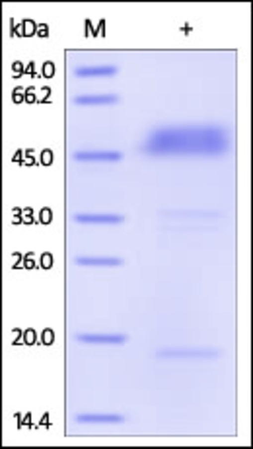 BTLA Recombinant Protein