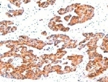Basic Cytokeratin Antibody [BCCK1-1]