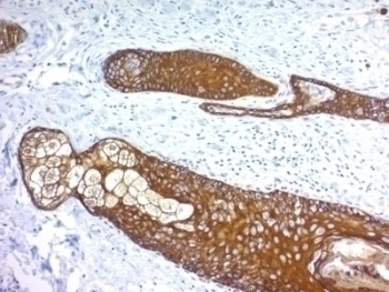 Basic Cytokeratin Antibody [KRTH/1076]