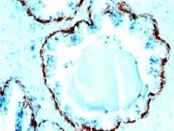 Basic Cytokeratin Antibody [SPM591]