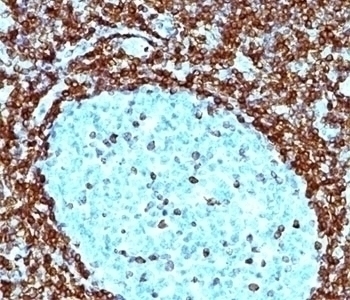 Bcl-2 Antibody [124]