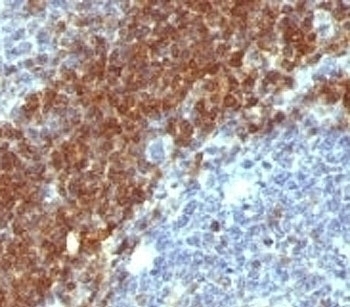Bcl-2 Antibody [SPM530]