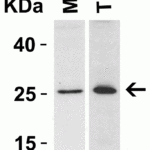 <strong>Figure 3 Western Blot Validation in Human Cell Lines</strong><br>Loading: 15 μg of lysates per lane.Antibodies: Bcl-2 3335, (2 μg/mL), 1h incubation at RT in 5% NFDM/TBST.Secondary: Goat anti-rabbit IgG HRP conjugate at 1:10000 dilution.