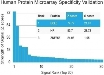 Bcl6 Antibody [BCL6/1475]