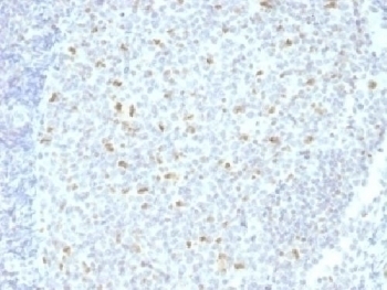 Bcl6 Antibody [BCL6/1526]