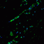 Immunofluorescence of Bcl9L in human breast tissue with Bcl9L antibody at 20 μg/ml.<br><br>Green: Bcl9L Antibody (6213) <br> Blue: DAPI staining