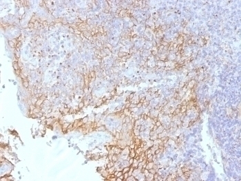 Beta Catenin Antibody [5H10]