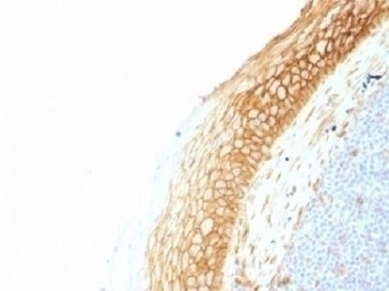 Beta Catenin Antibody [CTNNB1/1507]
