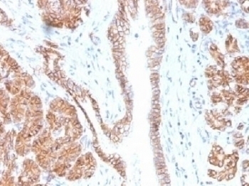 Beta Catenin Antibody [CTNNB1/1508]