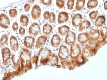 Beta Catenin Antibody [CTNNB1/1509]