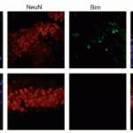 <strong>Figure 8 Induced Expression Validation of BIM in Mouse Hippocampus (Tsuchiya et al., 2011) </strong><br>The induction of Bim protein was detected by immunohistochemical analysis of mice after i.h. injection of epoxomicin with anti-BIM antibodies. Sections from epoxomicin-treated animals exhibited cells staining positive for Bim expression within the NeuN-positive population of neurons in the CA1 of the ipsilateral side. In contrast, Bim-positive cells were absent within the NeuNpositiveCA1 neurons on the contralateral side.