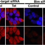 <strong>Figure 9 KD Validation of BIM in 293 Cells (Han et al., 2010) </strong><br>Immunofluorescence analysis with anti-BIM antibodies was performed for BIM in 293 cells transfected with control siRNA or BIM siRNA. BIM expression was disrupted after BIM siRNA knockdown.