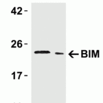 <strong>Figure 3 Western Blot Validation in Human Tissue</strong><br>Loading: 15 μg of lysates per lane.Antibodies: BIM 3405, (5 μg/mL), 1h incubation at RT in 5% NFDM/TBST.Secondary: Goat anti-rabbit IgG HRP conjugate at 1:10000 dilution.Lane 1: Human urinary bladderLane 2: Human pancreas