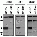 <strong>Figure 10 KD Validation of BIM in Human Cell Lines (Chen et al., 2009) </strong><br>Human leukemia (U937 and Jurkat) and myeloma (U266) cells were stably transfected with constructs encoding shBim or a scrambled sequence (shNC). Immunoblotting was preformed to monitor expression of Bim in these cells with anti-BIM antibodies. BIM expression was disrupted after shBIM