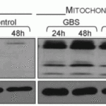 <strong>Figure 11 Localization Validation of BIM in Mouse Macrophages (Ulett et al., 2005) </strong><br>Immunoblots of subcellular fractions enriched for mitochondria and cytosol were used to determine BIM protein levels with anti-BIM antibodies in J774A cells. BIM is exclusively expressed in mitochondria.