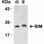 <strong>Figure 1 Western Blot Validation in Human Cell Lines</strong><br>Loading: 15 μg of lysates per lane.Antibodies: BIM 3405, (5 μg/mL), 1h incubation at RT in 5% NFDM/TBST.Secondary: Goat anti-rabbit IgG HRP conjugate at 1:10000 dilution.