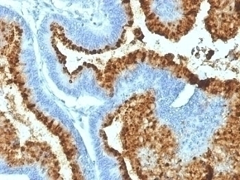Blood Group Antigen B Antibody [HEB-20]