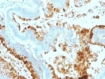 Blood Group Lewis a Antibody [7LE]