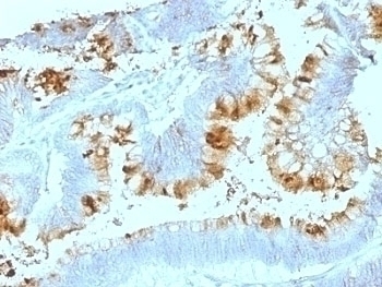 Blood Group Lewis a Antibody [SPM522]