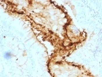 Blood Group Lewis y Antibody [A70-A/A9]