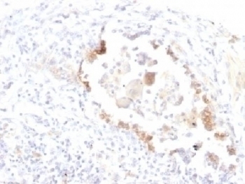 Blood Group Lewis y Antibody [LWY/1463]