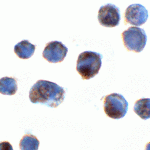 Immunocytochemistry of C18orf42 in HeLa cells with C18orf42 antibody at 2 μg/mL.