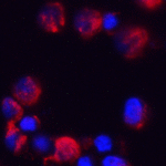 Immunofluorescence of C18orf42 in HeLa cells with C18orf42 antibody at 2 μg/mL.<br><br>Red: C18orf42 Antibody (8471) <br> Blue: DAPI staining