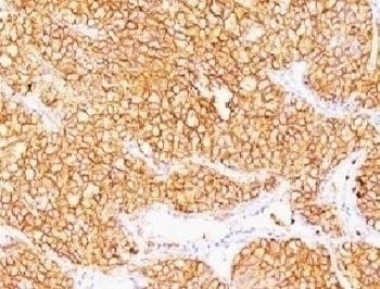 CA9 Antibody [SPM314]