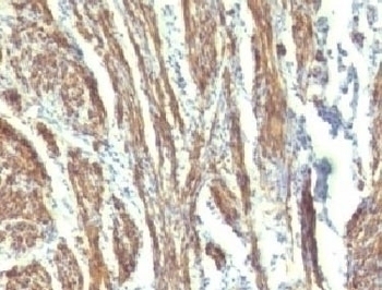 CAD Antibody [CDSM-3]