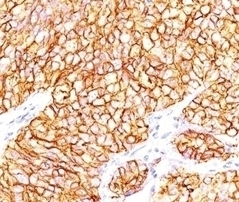 CAIX Antibody [66.4.C2]