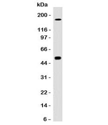CAIX Antibody [CBAD9-1]
