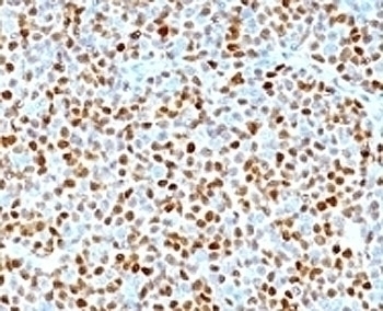 CCND1 Antibody [SPM587]