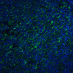 Immunofluorescence of CCR5 in human lymph node tissue with CCR5 antibody at 20 μg/mL.<br><br>Green: CCR5 Antibody (1112) <br> Blue: DAPI staining