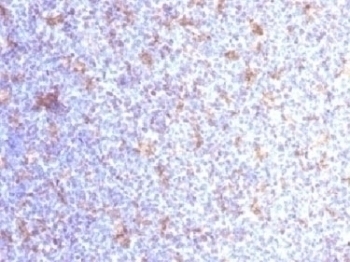 CD11c Antibody [ITGAX/1284]