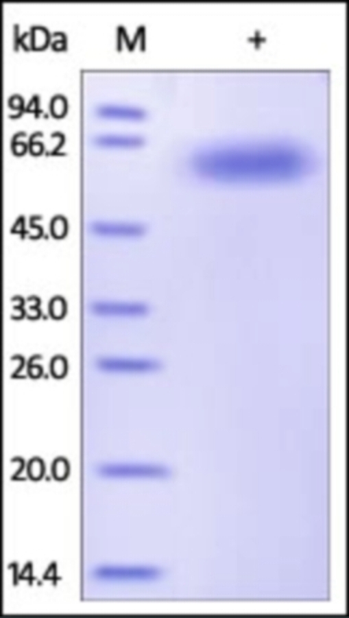 CD122 Recombinant Protein