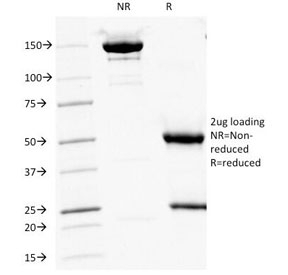 CD16 Antibody [HuNK2]
