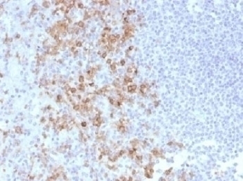 CD162 Antibody [PSGL1/1601]