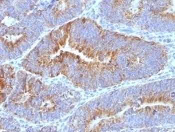 CD176 Antibody [SPM320]