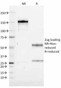 CD19 Antibody [CVID3/155]