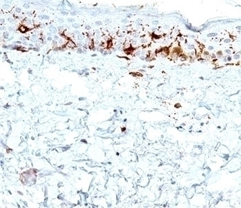 CD1a Antibody [C1A/711]