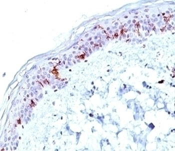 CD1a Antibody [O10]