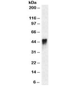 CD2 Antibody [HuLy-m1]