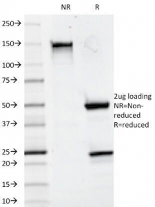 CD20 Antibody [93-1B3]