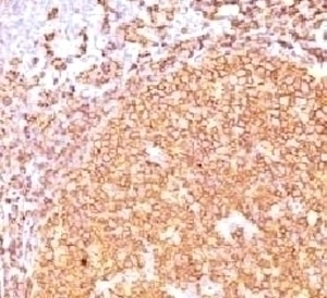CD20 Antibody [CDLA20-1]