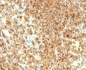 CD20 Antibody [IGEL/773]