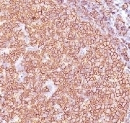 CD20 Antibody [SPM618]