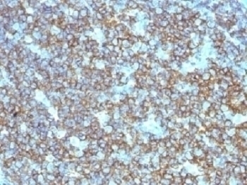 CD20 Antibody